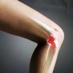 Лечение артроза коленного сустава - частная клиника в Казахстане